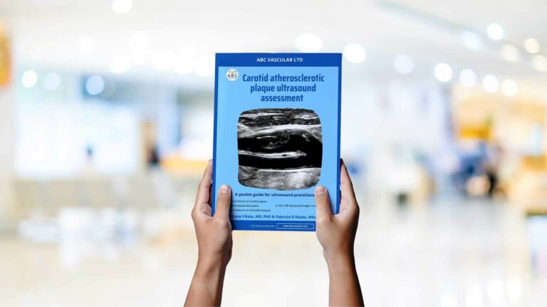 A New Practical Guide on the Ultrasound Assessment of Carotid Atherosclerotic Plaques