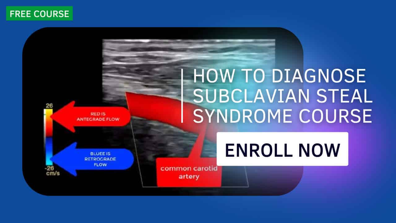 How to Diagnose Subclavian Steal Syndrome Course