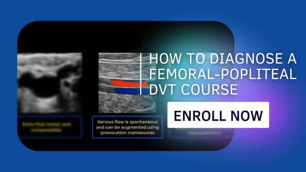 How to Diagnose a Femoral-Popliteal DVT Course + CME Quiz