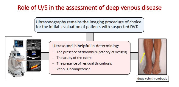 DVT Deep Vein Thrombosis Awareness Month 2023