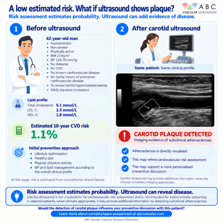 Selective Carotid Screening in Asymptomatic Patients