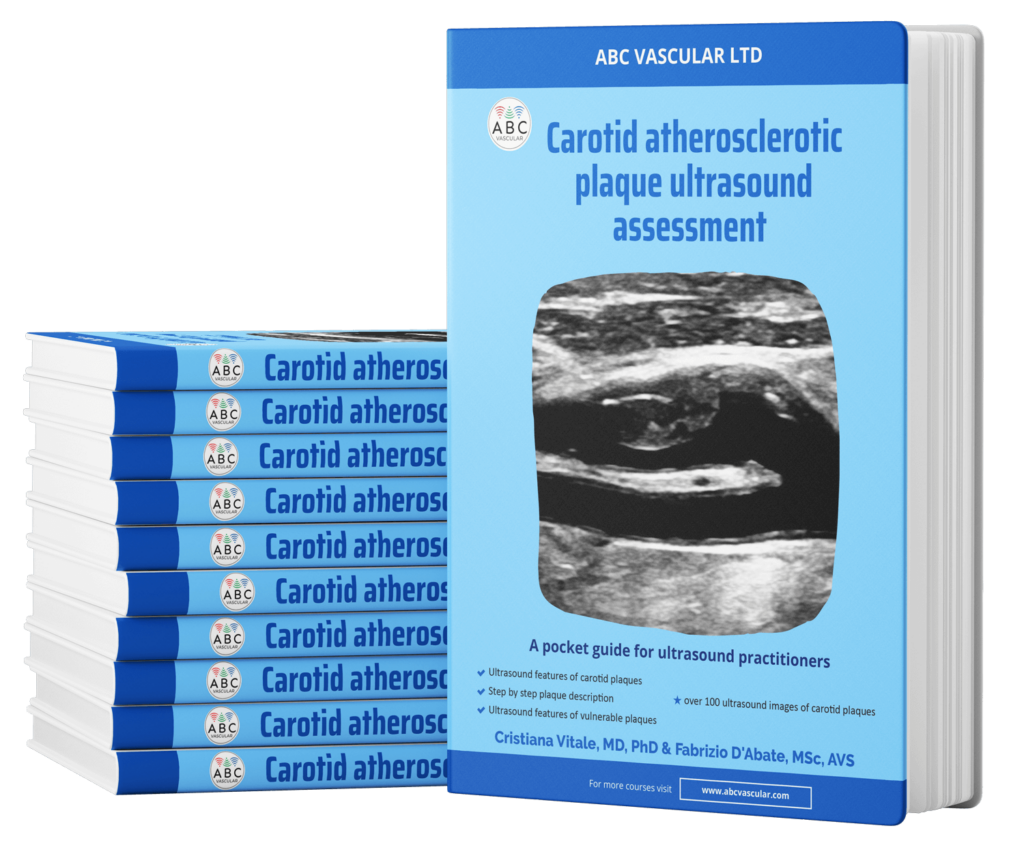 Vascular Ultrasound Book ABC Vascular vascular-ultrasound-book-abc-vascular